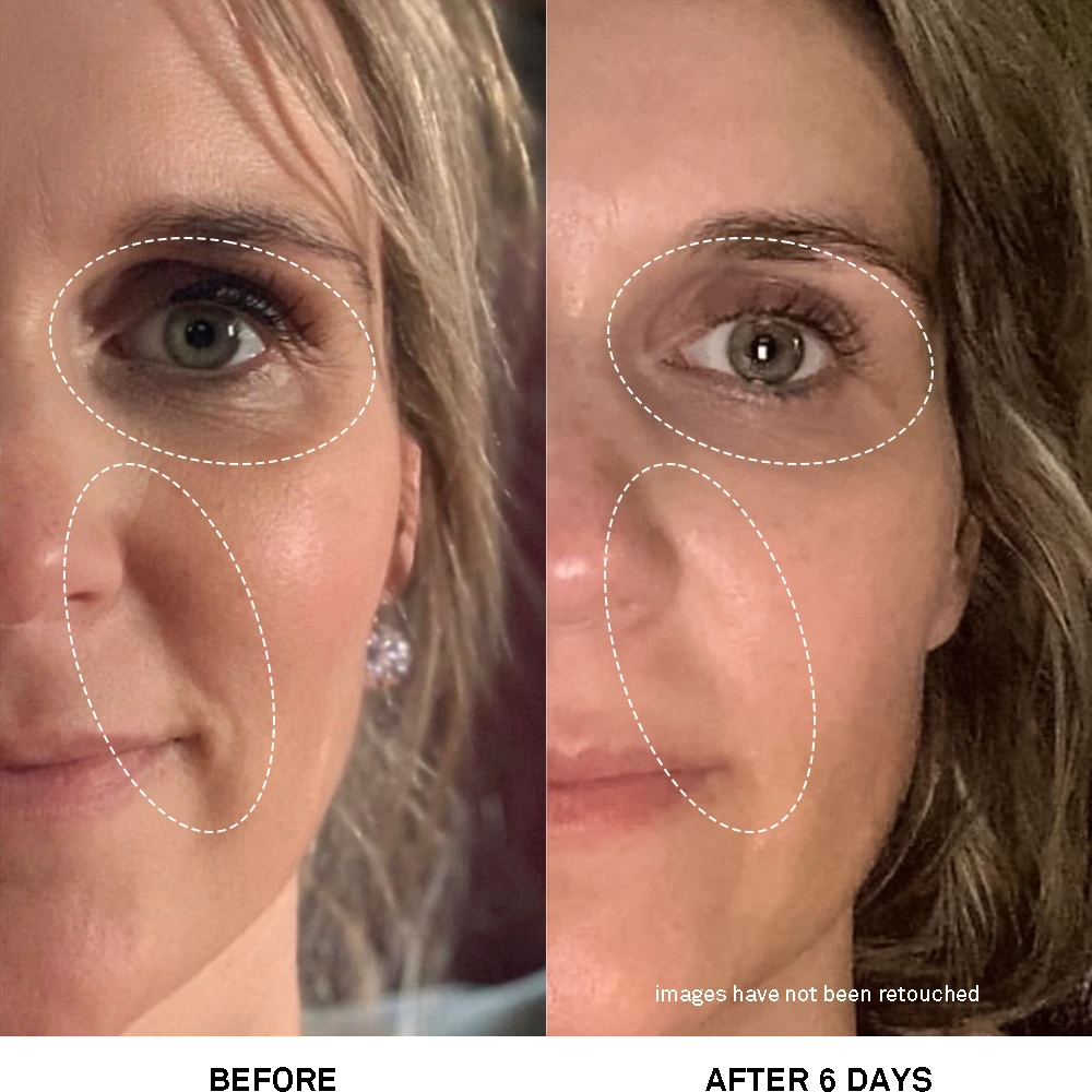 Team Dr. Joseph Advanced Rejuvenating Power Treatment