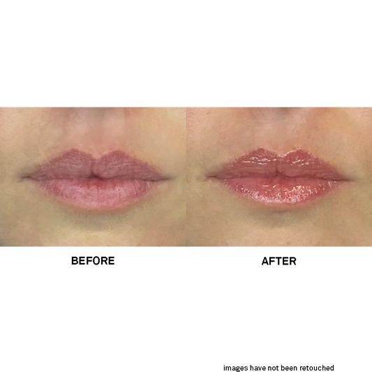 Team Dr. Joseph Soft Lips Glow Balm