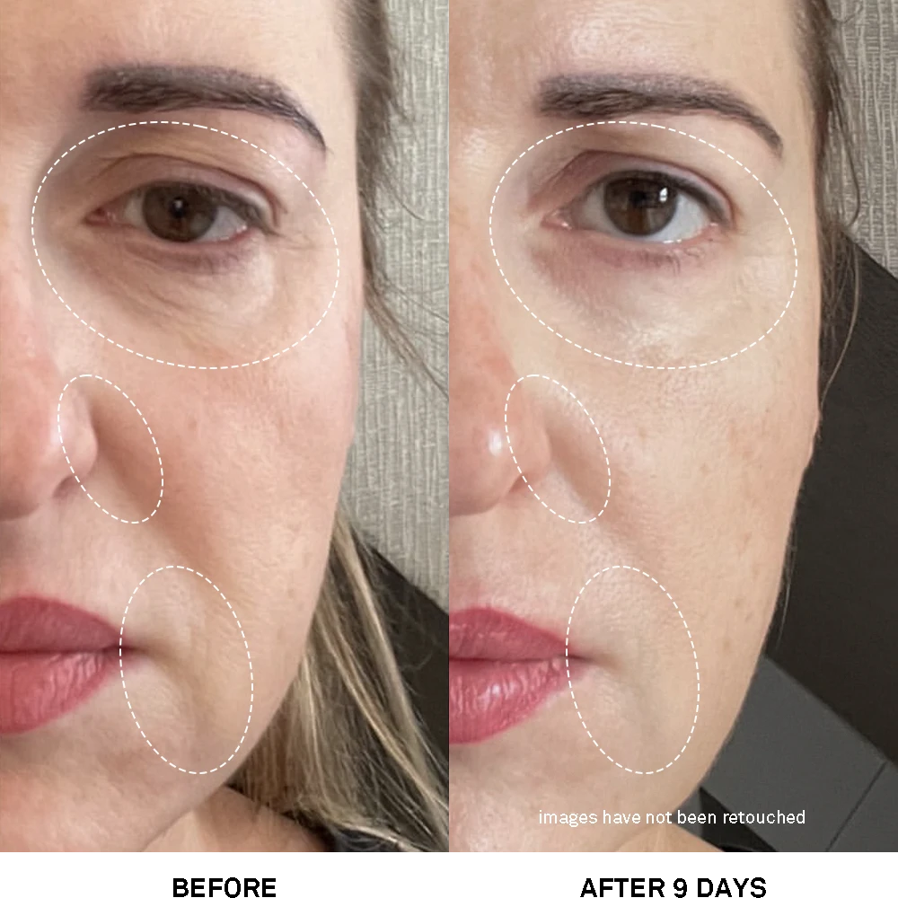 Team Dr. Joseph Advanced Rejuvenating Power Treatment