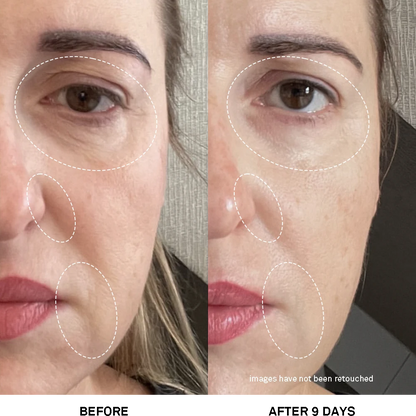 Team Dr. Joseph Advanced Rejuvenating Power Treatment