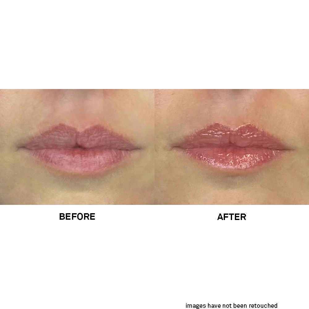 Team Dr. Joseph Soft Lips Glow Balm