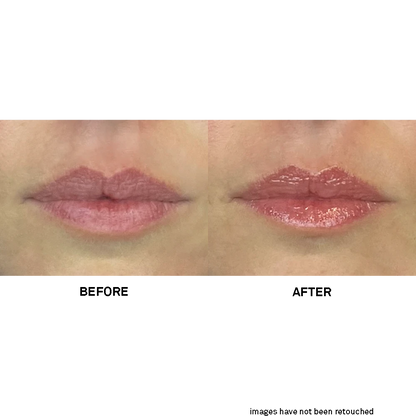 Team Dr. Joseph Soft Lips Glow Balm